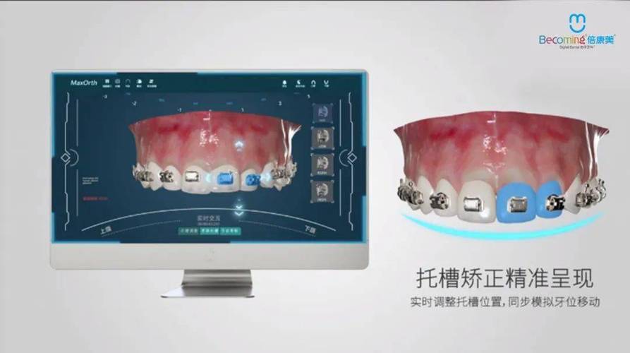 正畸模型数字化管理-图1