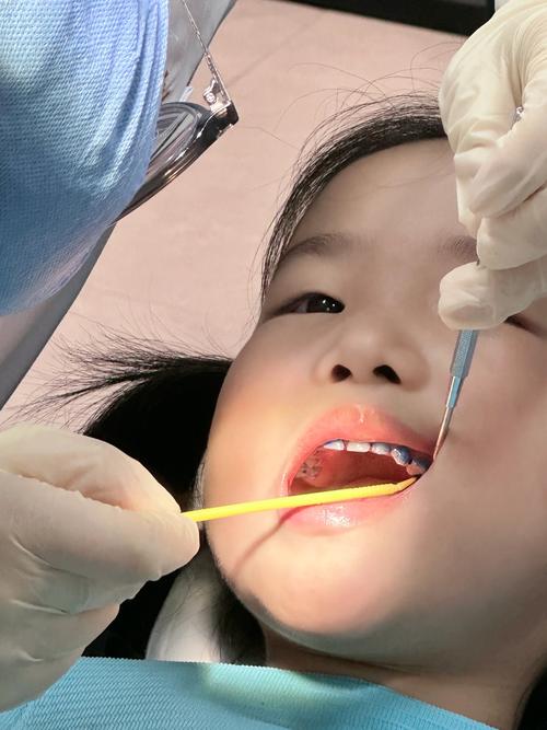 南京童盺种牙-图2