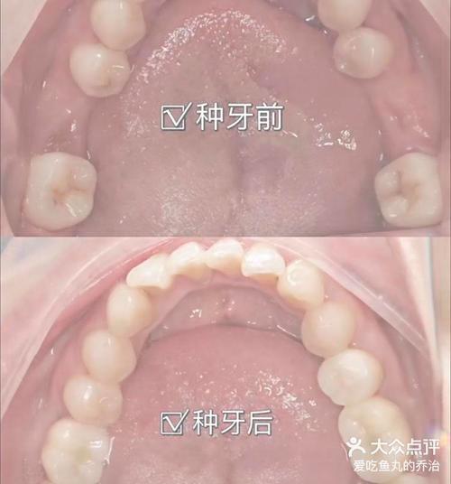 南京童盺种牙-图3