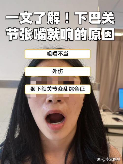 正畸期间 颌关节痛-图2 正畸期间 颌关节痛-图2