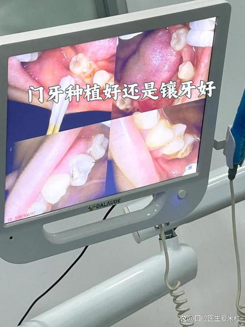 我种的牙用了-图3