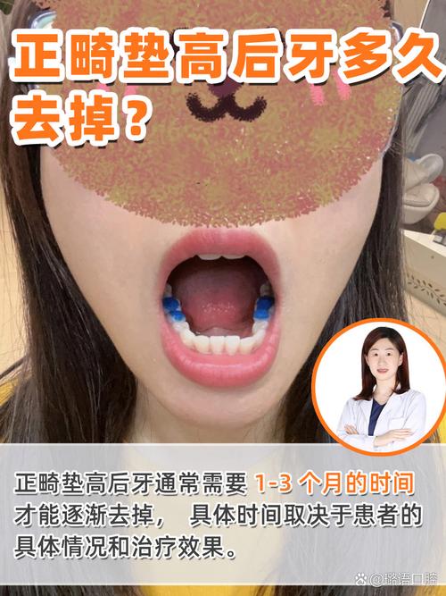 牙齿正畸需要加颌垫-图2