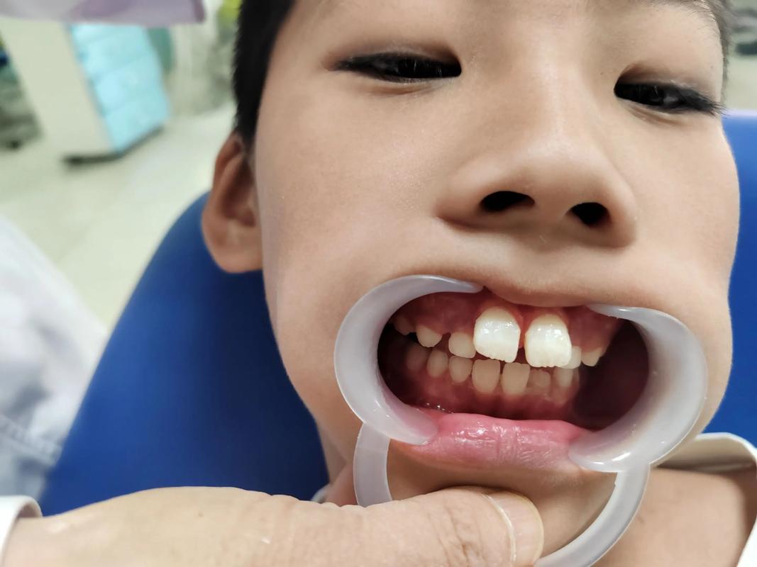 正畸期间可以要小孩吗？正畸会影响怀孕和生育吗？-图2