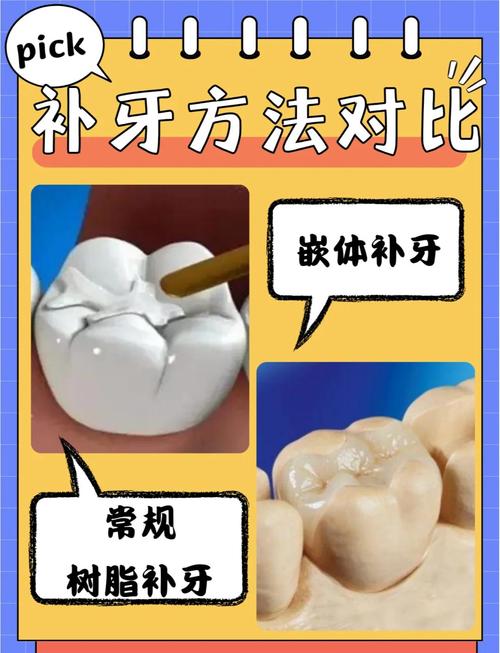 不种牙怎么补-图3 不种牙怎么补-图3