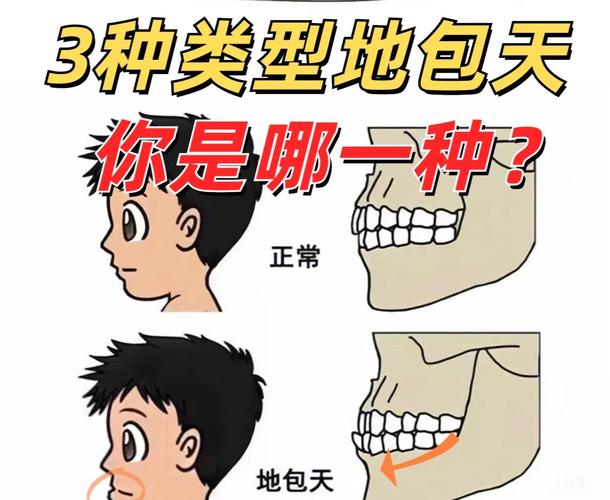 包牙有多少种-图3