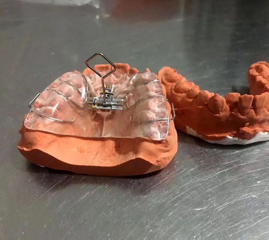 正畸螺旋扩弓器拆解-图1