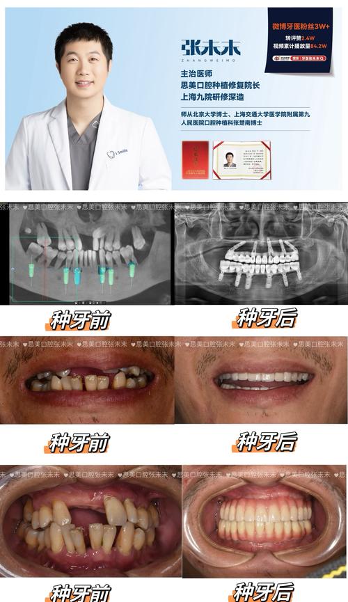 种牙后咬合力-图1