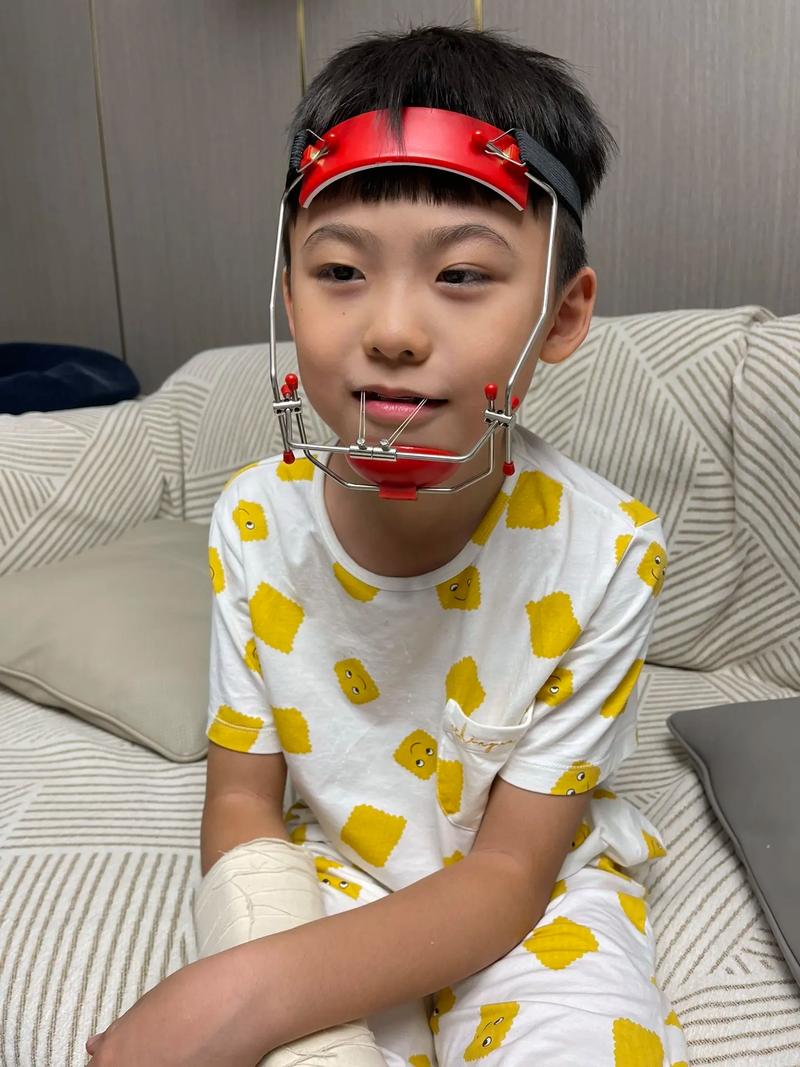 正畸弹簧断了怎么办-图3