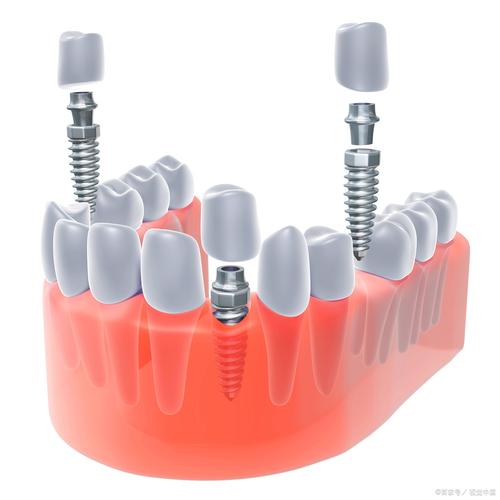 德国卡瓦种牙-图2