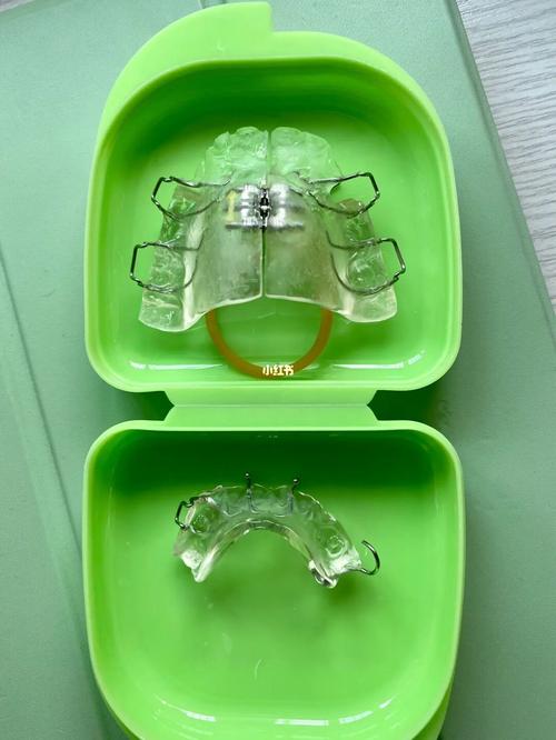 牙齿正畸颌垫是什么？矫正中起什么作用？-图2