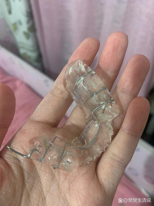 牙齿正畸颌垫是什么？矫正中起什么作用？-图1