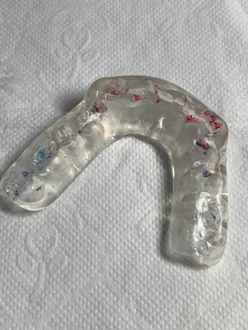 牙齿正畸颌垫是什么？矫正中起什么作用？-图3