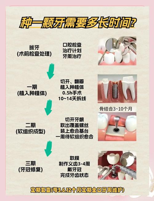 种牙什么时候-图2