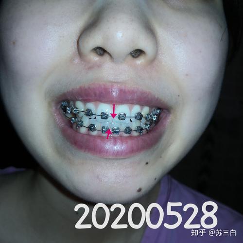 上海口腔防治院正畸-图3