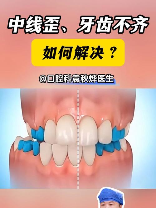 正畸中线不齐怎么办-图1