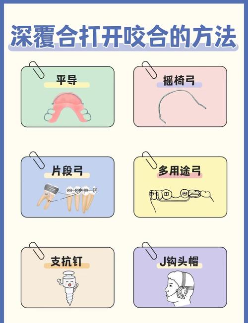 正畸中线不齐怎么办-图3