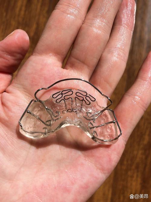 口外正畸牵引器图片能展示哪些关键结构？-图3