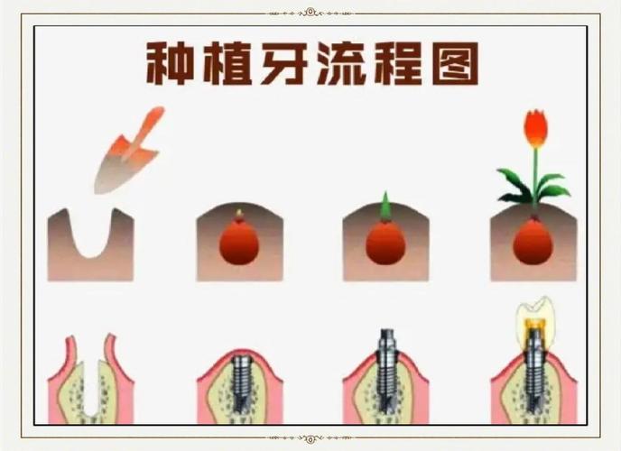 百康种牙流程-图3