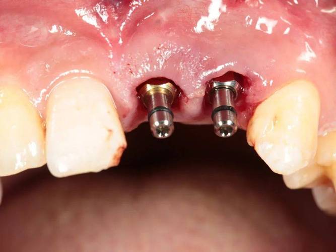 太仓陆渡种牙-图3