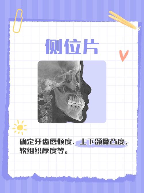 正畸软组织测量z角-图3