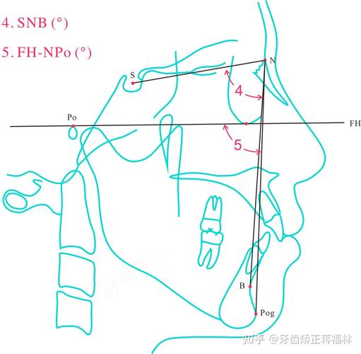 正畸软组织测量z角-图2