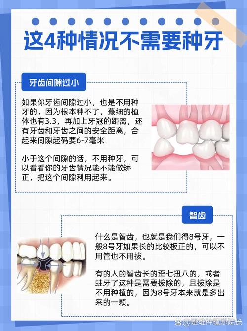 不镶牙不种牙-图1