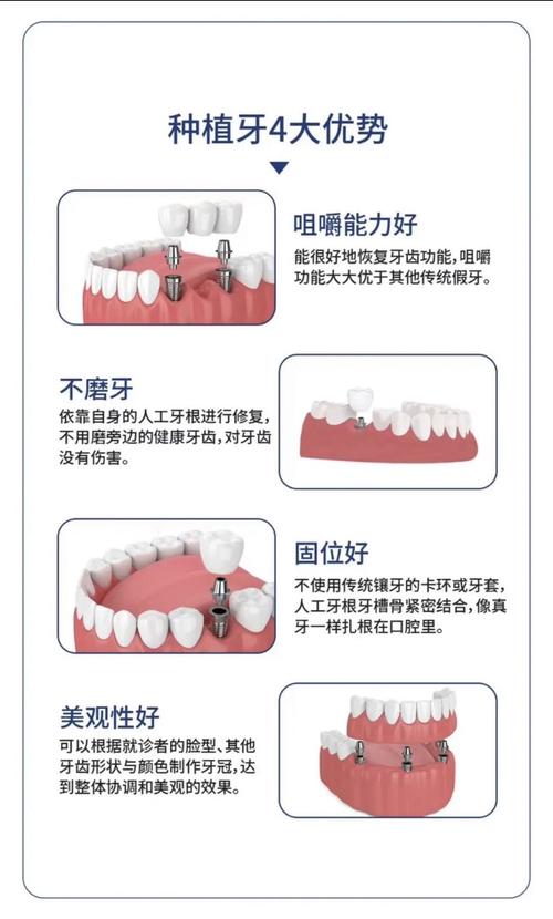 比种牙更先进-图1