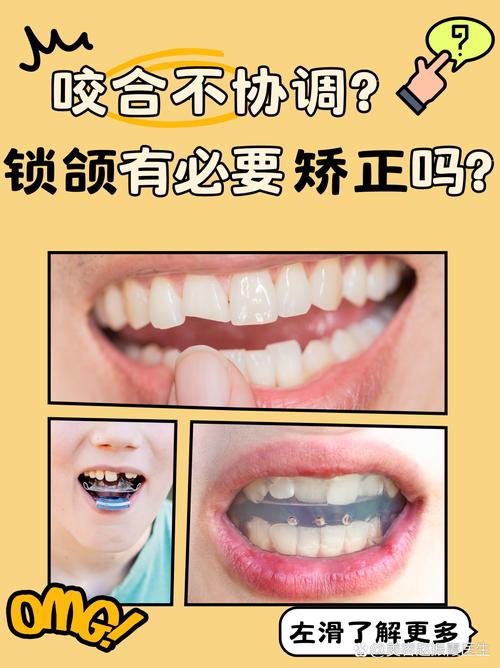 正畸会影响鄂关节吗-图1 正畸会影响鄂关节吗-图1