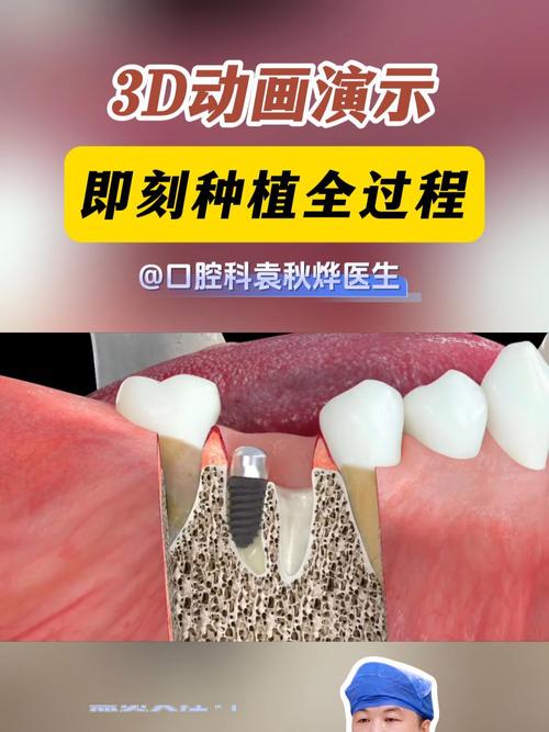 种牙视频感想-图3 种牙视频感想-图3