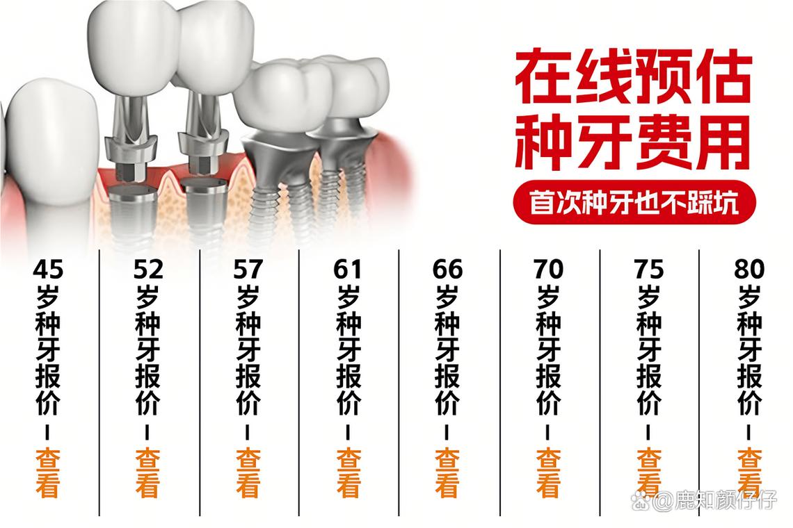 珠海种牙收费-图1