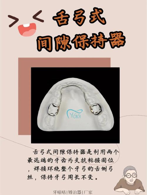 正畸保持牙周纤维带-图3