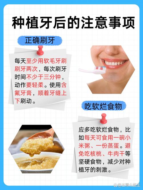 深圳种牙流程是怎样的？步骤、时间、费用需了解清楚？-图3