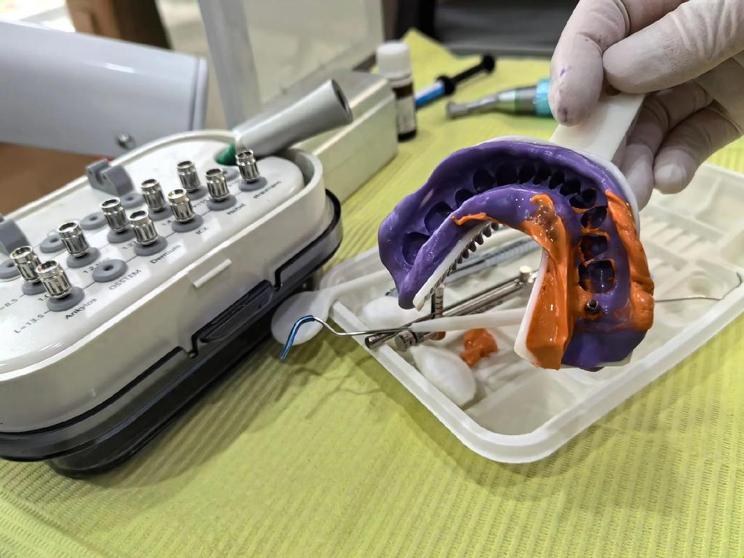 瑞典种牙技术-图1