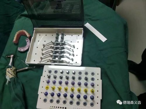 正畸数字化定位导板如何辅助精准牙齿定位与矫治？-图1