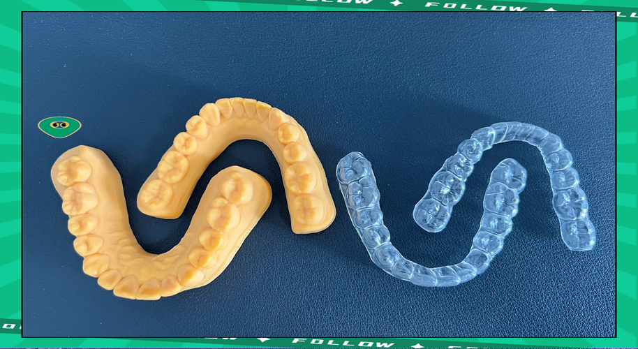 正畸透明压膜保持器，矫正后为何必须戴？-图1