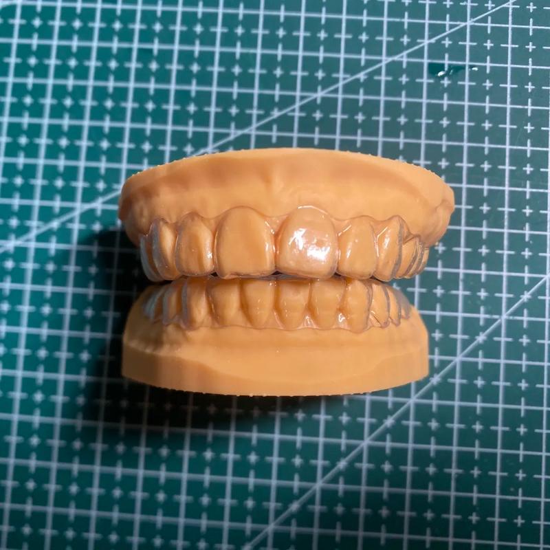 正畸透明压膜保持器，矫正后为何必须戴？-图3