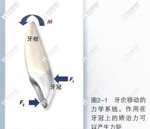 正畸控和移动分别指什么？-图2