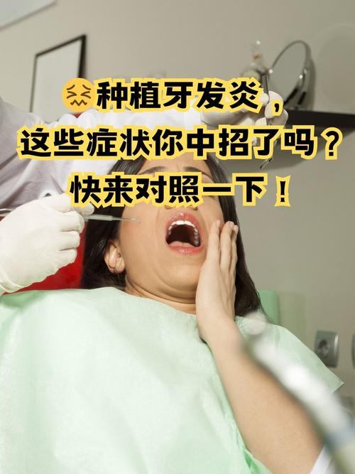 种牙术后发炎-图3