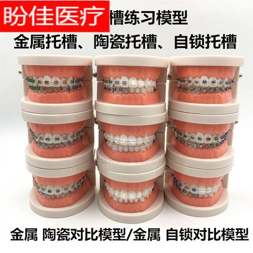 正畸弓丝没有入托槽-图1