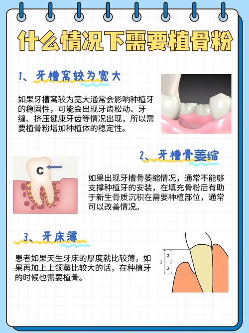 正畸前需要植骨粉吗-图2 正畸前需要植骨粉吗-图2