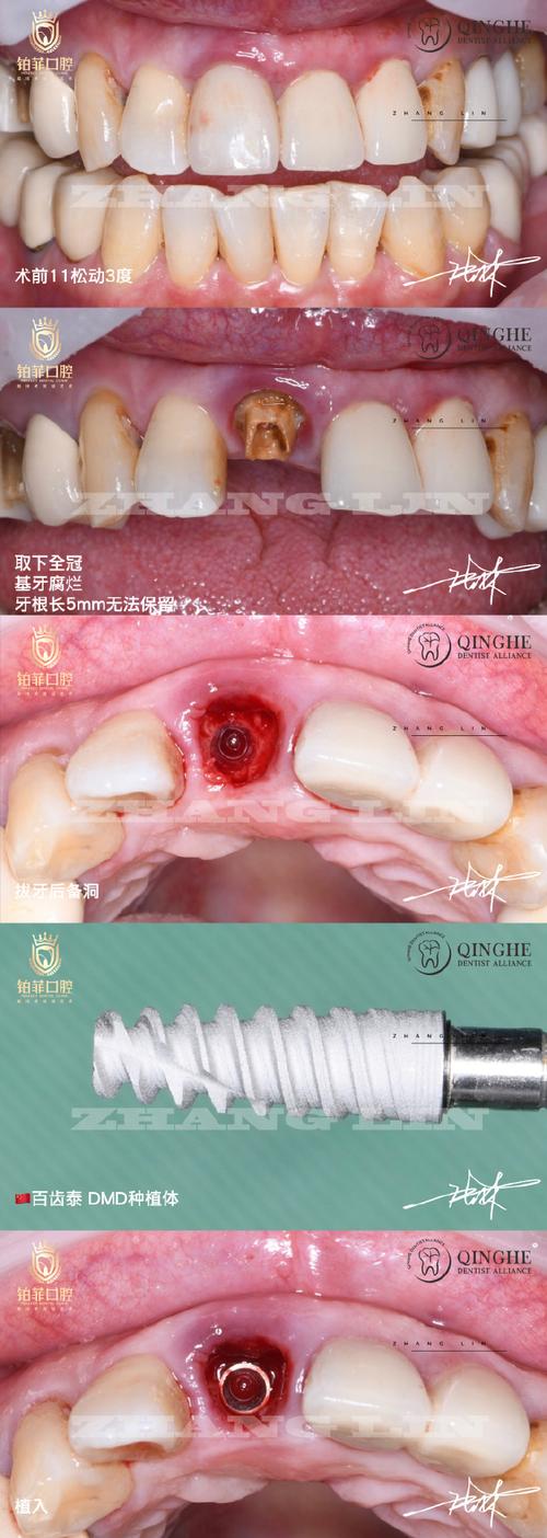 种牙病例采集-图3