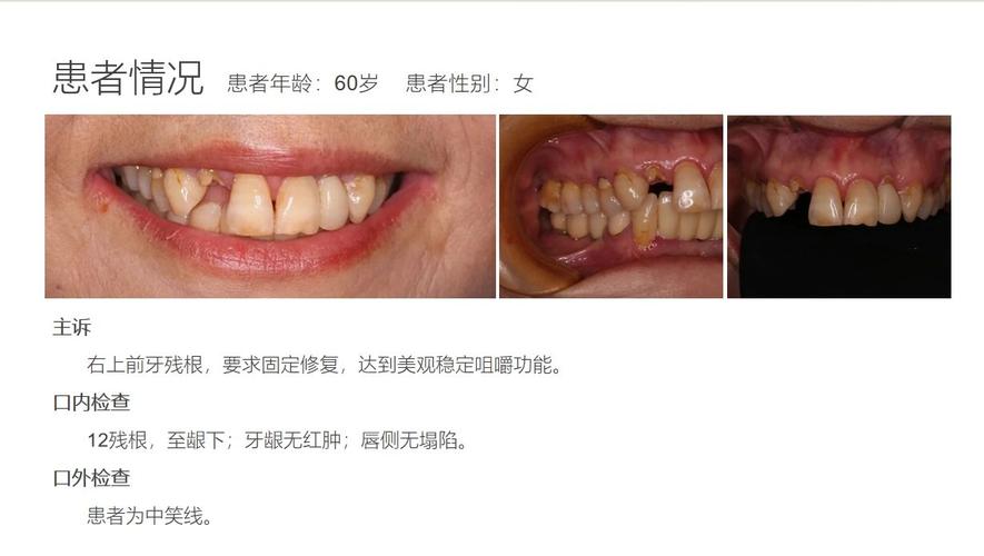 种牙病例采集-图2