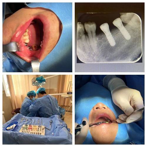 种牙获得新生-图3