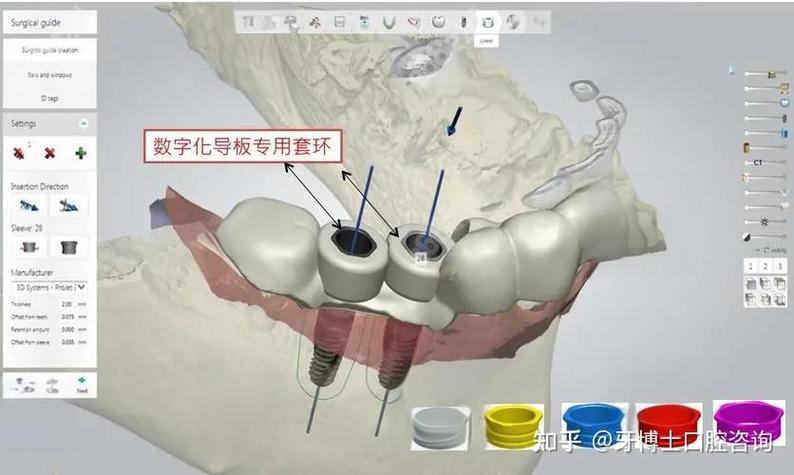 合肥种牙哪里-图2