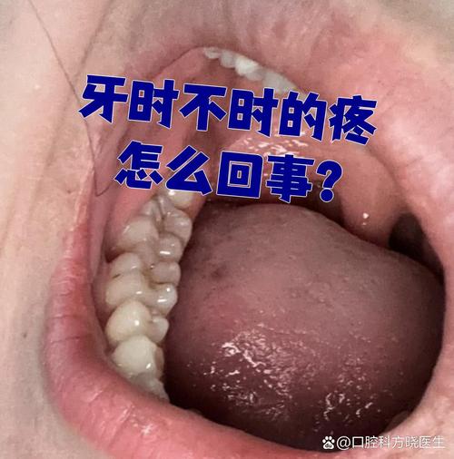 种牙神经麻木-图2