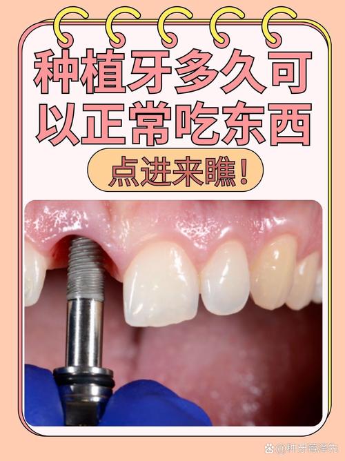 佳美种牙好吗-图2