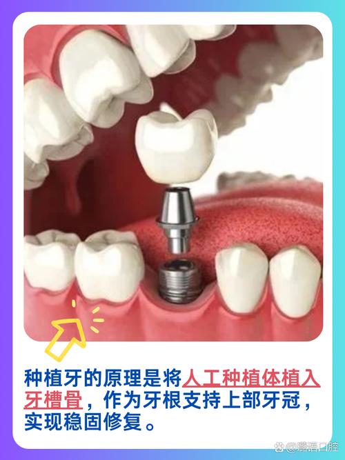 种牙如何复查-图3