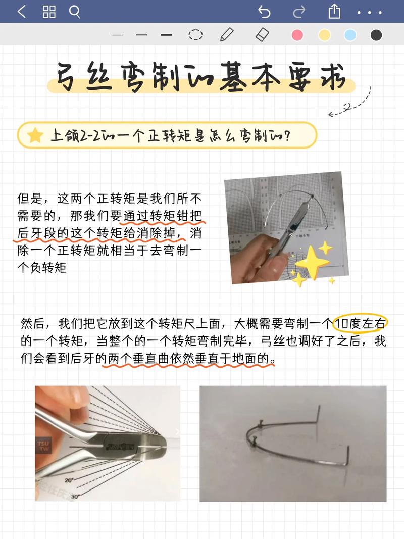 正畸弓丝怎么移动的-图1