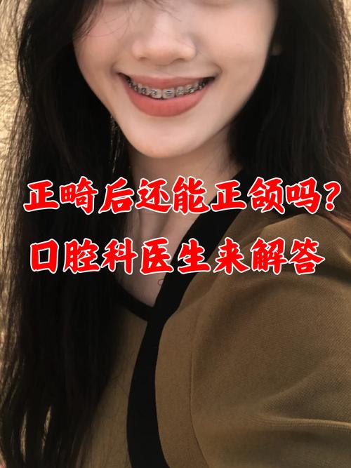 做过正畸还能正颌吗-图1 做过正畸还能正颌吗-图1