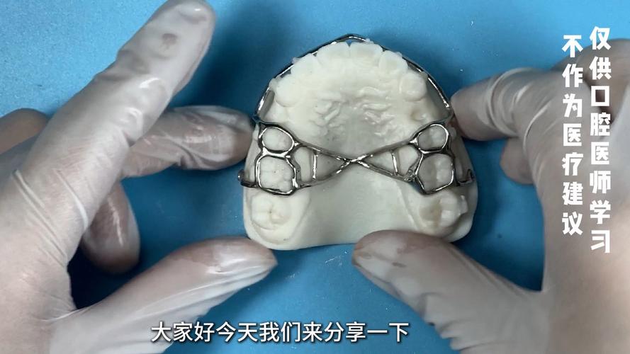 正畸内收前牙的装置-图1